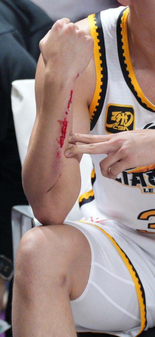 篮球运动员大伤